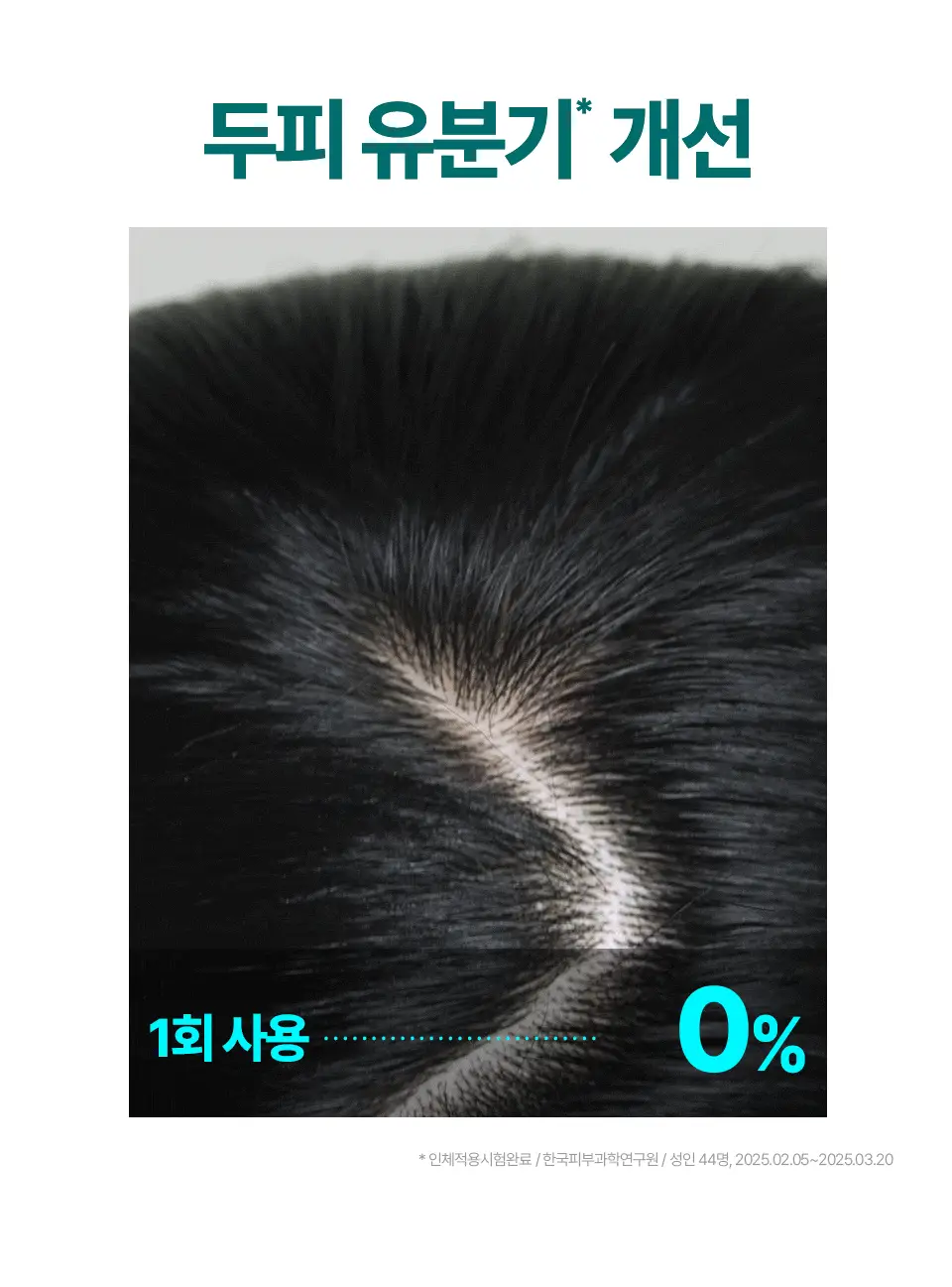 [비듬두피/정수리냄새] 트리셀 안티 댄드러프 샴푸 오션 브리즈 증정 기획(360ml+120ml) 상세페이지 15